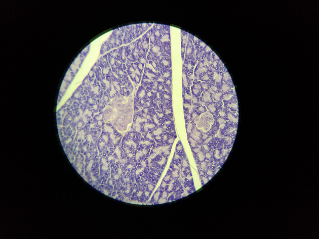 Pancreas Slides - Pancreas 008 100X